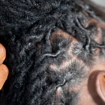 dreadlocks_center