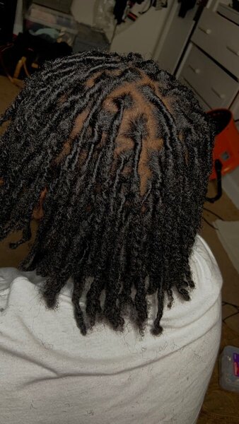 Dreadlocks-Ansatzpflege  